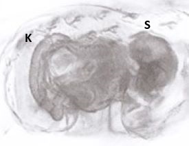 Palliduphantes ericeus;epigyna-laterální pohled © Antonín Roušar